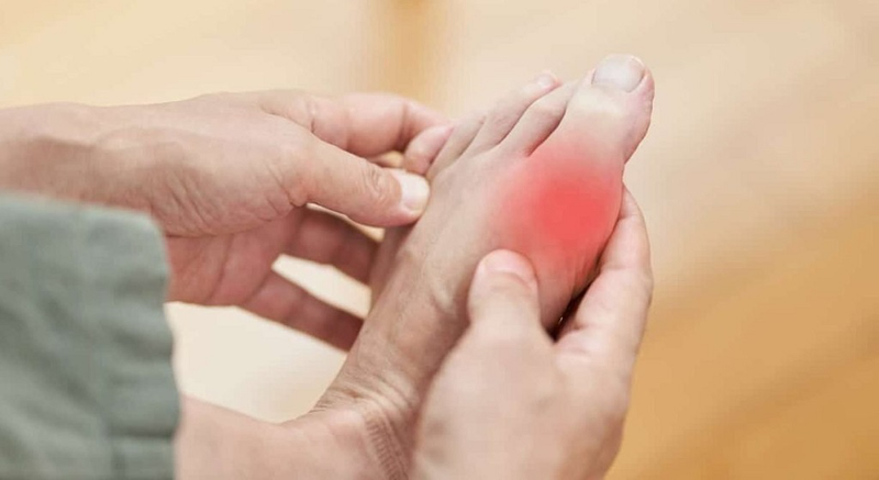 Bị gút có nên chườm đá lạnh không? Những điều bệnh nhân cần lưu ý