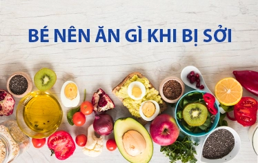 4 nhóm thực phẩm giúp trẻ đối phó với bệnh sởi