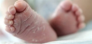 BÍ QUYẾT CHĂM SÓC TRẺ BỊ DA KHÔ GIÚP CÁC BẬC PHỤ HUYNH