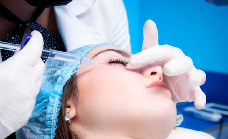 Lưu ý khi tiêm filler làm đẹp toàn diện