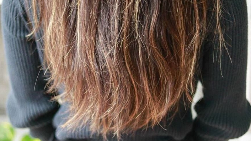 Bí quyết phục hồi nang tóc tự nhiên, an toàn và đơn giản