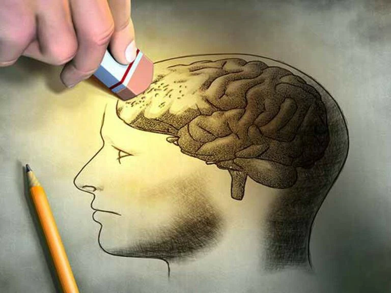 Bệnh Alzheimer: Triệu chứng, chẩn đoán và điều trị
