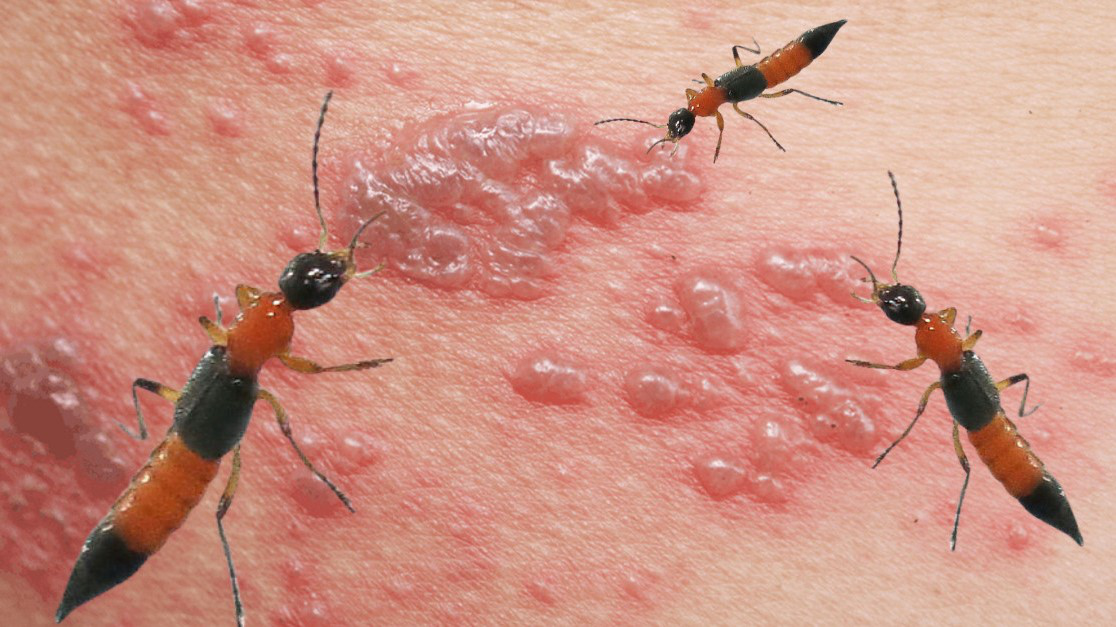 NHẬN BIẾT DẤU HIỆU KIẾN BA KHOANG ĐỐT VÀ CÁCH XỬ TRÍ