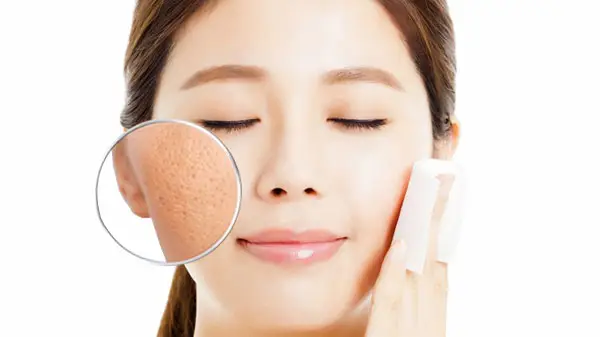 Liệu trình se khít lỗ chân lông thu nhỏ tại nhà an toàn và hiệu quả