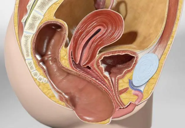 Cảnh giác: Táo bón kéo dài dễ bị sa trực tràng