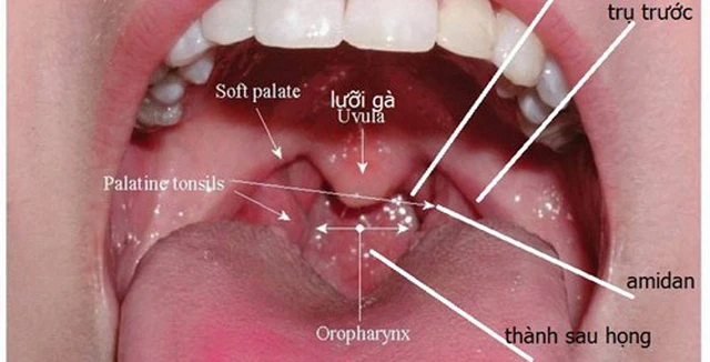 Bài tập thể dục phù hợp cho bệnh nhân ung thư vòm họng