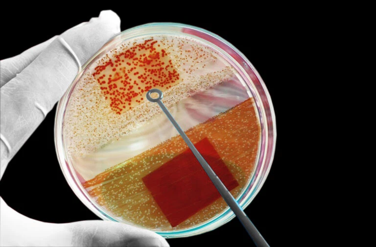 Bệnh hạ cam: Nguyên nhân, triệu chứng, cách chẩn đoán và điều trị