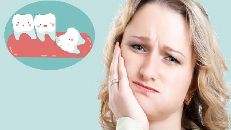 Thời gian và cách giảm sưng đau sau khi nhổ răng khôn