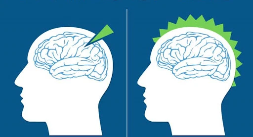 Chấn thương sọ não kín: nguyên nhân, triệu chứng và cách điều trị