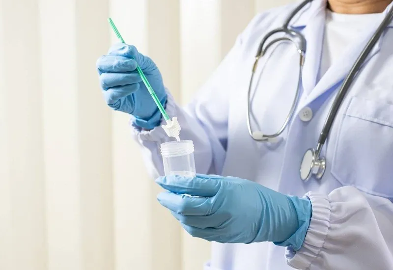 Ung thư cổ tử cung: tầm soát sớm và phòng ngừa