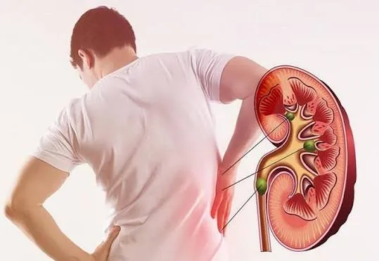 Cảnh báo xu hướng suy thận trẻ hóa do lối sống hiện đại
