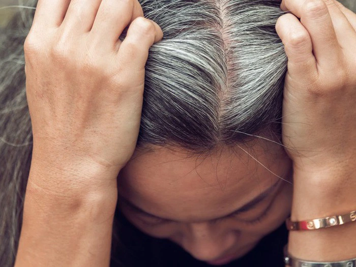 Khi nào tóc bắt đầu bạc ? Những nguyên nhân khiến tóc bạc sớm