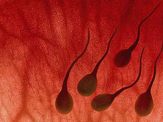 Màu sắc tinh dịch thay đổi thế nào thì nên đi khám?