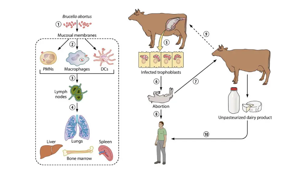 Bệnh Brucellosis: Những điều bạn cần biết!