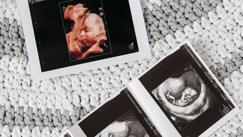 Bà bầu uống ít nước có sao không?