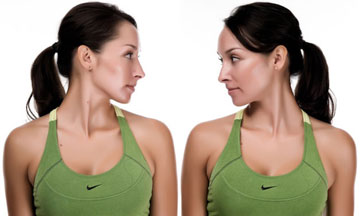 Bài tập cho người bệnh đau dây thần kinh chẩm