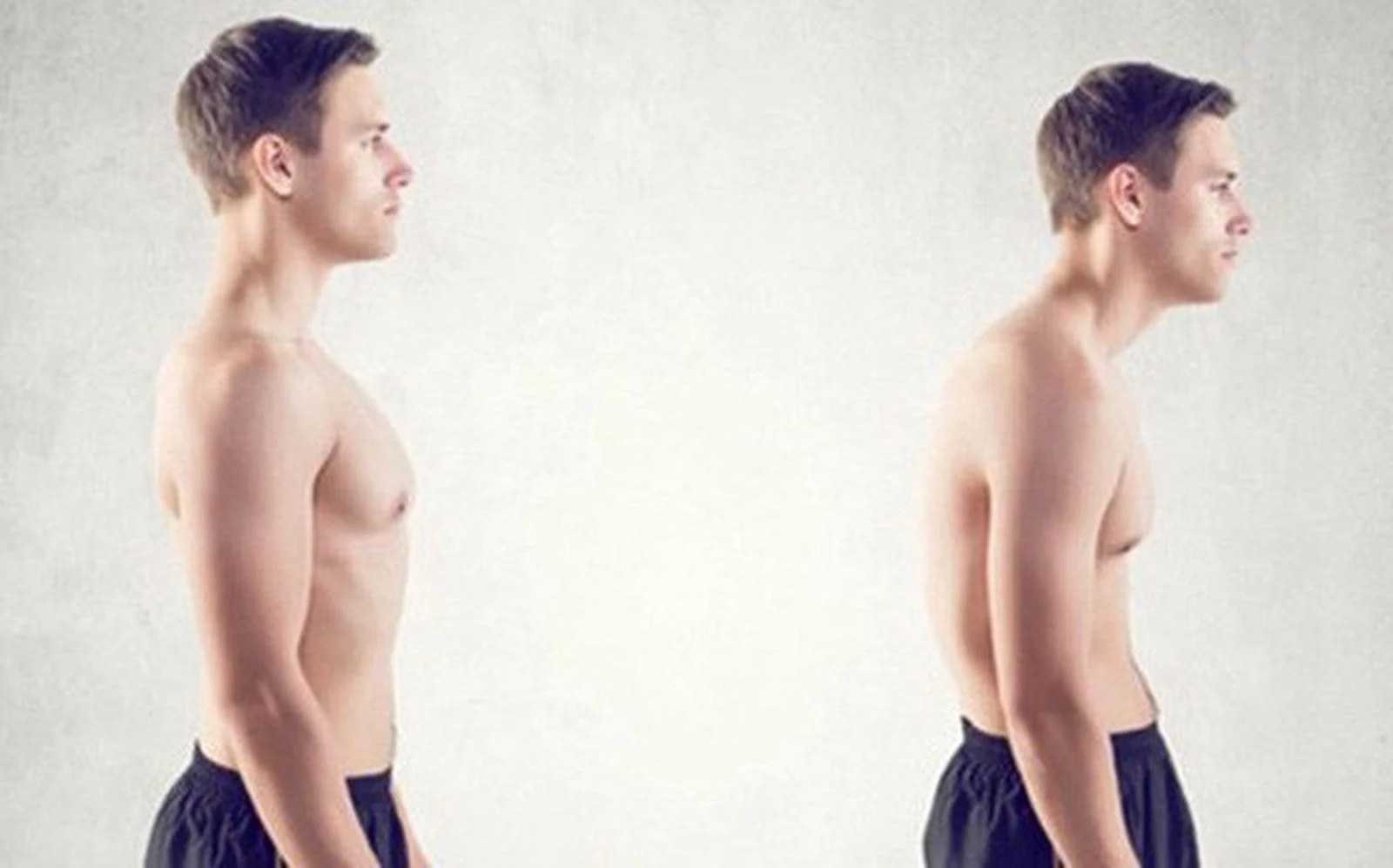 Gù cột sống: Nguyên nhân, triệu chứng, chẩn đoán và điều trị