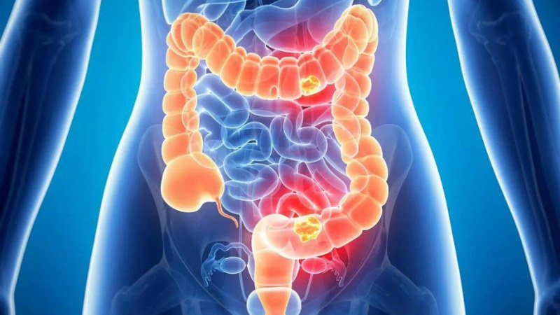 Có nên lạm dụng thuốc thụt hậu môn khi bị táo bón ?