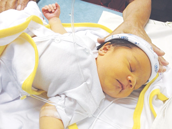 Phân biệt vàng da sinh lý và vàng da bệnh lý ở trẻ sơ sinh