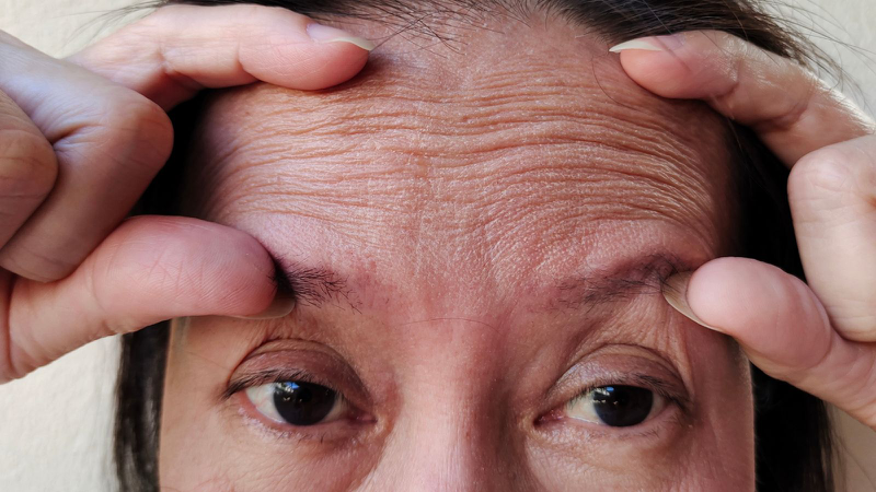 5 bài tập cho cơ trán giúp giảm nếp nhăn, cải thiện độ săn chắc