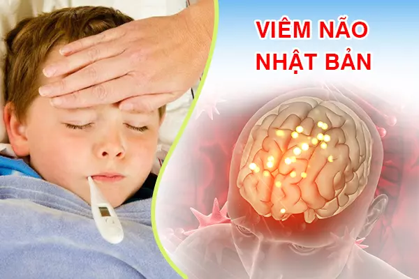 Viêm não Nhật Bản: Dấu hiệu, nguyên nhân và cách phòng ngừa