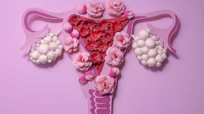 Các nguyên nhân đa nang buồng trứng: Hiểu rõ để phòng ngừa