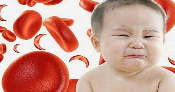 7 dấu hiệu nhận biết trẻ thiếu máu, thiếu sắt cha mẹ cần nắm chắc