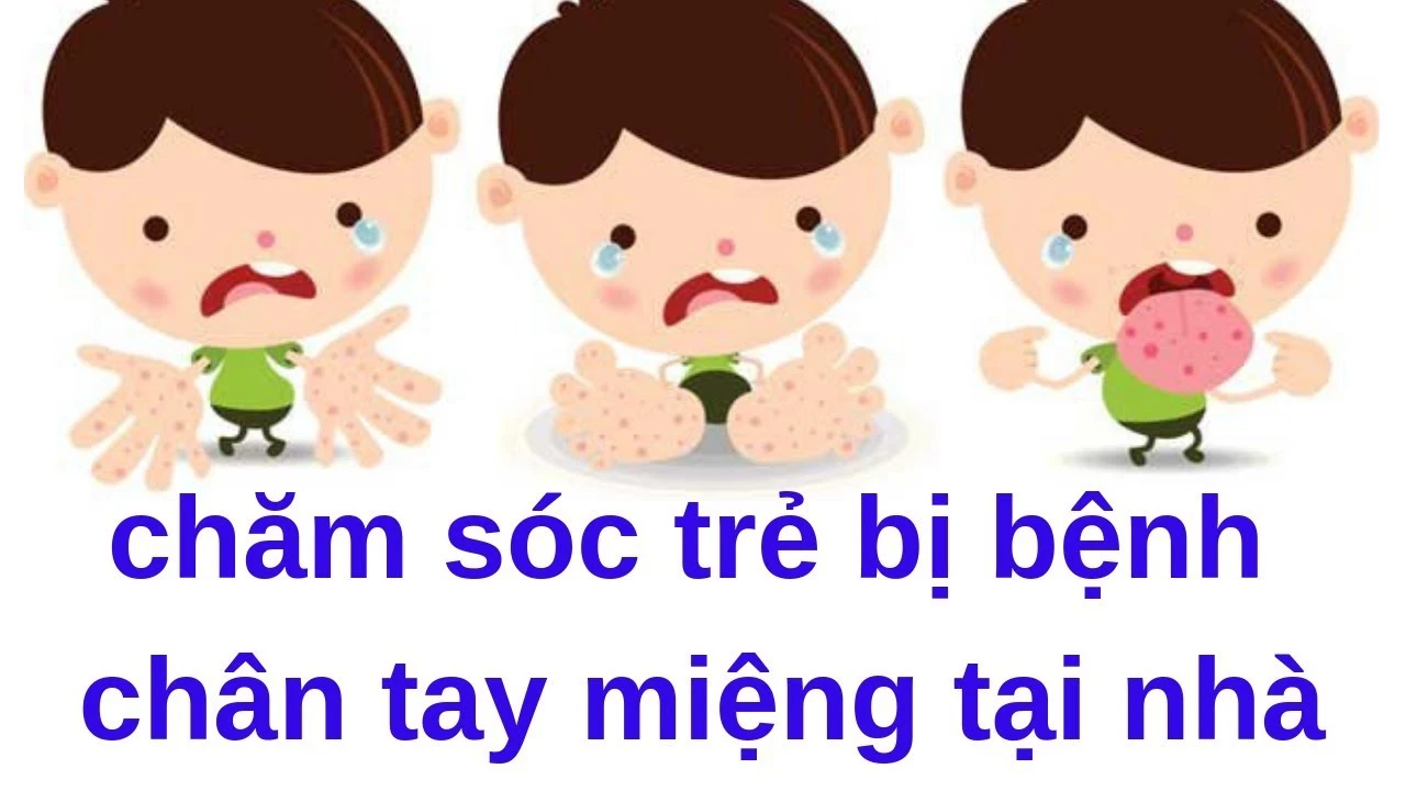 6 CÁCH CHĂM SÓC TRẺ BỊ TAY CHÂN MIỆNG TẠI NHÀ HIỆU QUẢ MẸ CẦN BIẾT