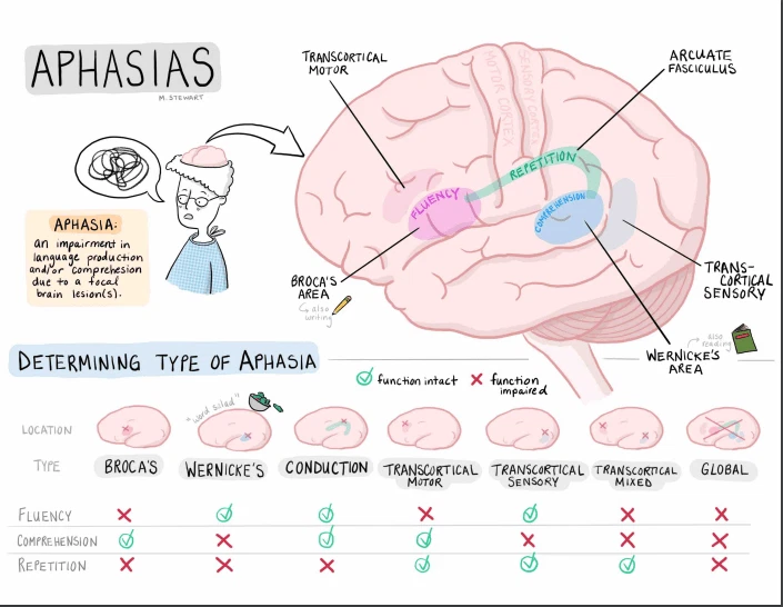 Chứng mất ngôn ngữ (APHASIA)