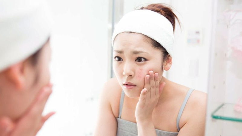 Mụn bọc là mụn như thế nào? Các dấu hiệu nhận biết mụn bọc