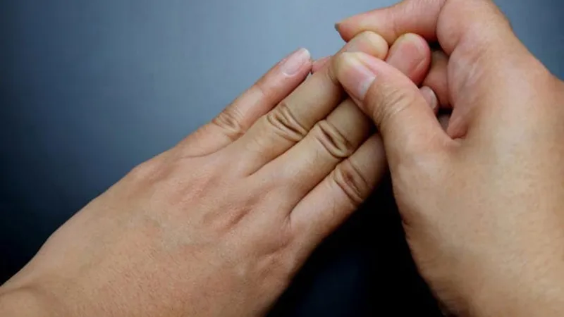 Truyền nước bị phù tay: nguyên nhân và cách giải quyết