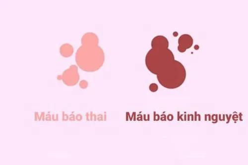 Phân biệt máu báo mang thai và ra máu kinh nguyệt