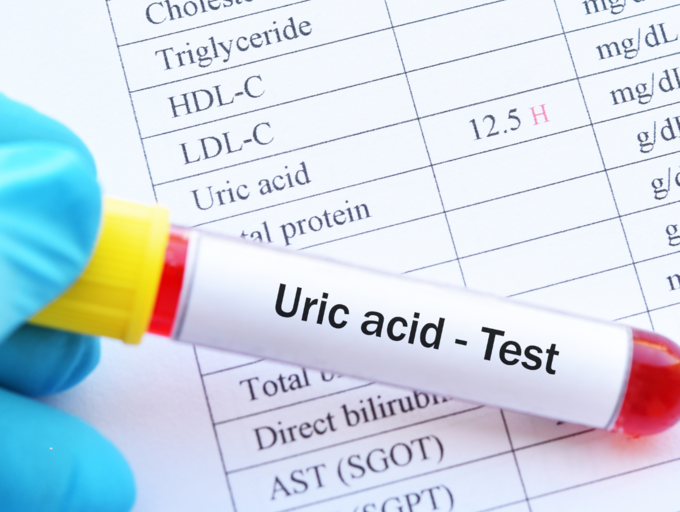 5 biện pháp giảm nồng độ axit uric hiệu quả